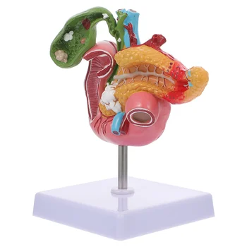 Модель поджелудочной железы человека, патологическая модель двенадцатиперстного желчного пузыря, учебный инструмент 0