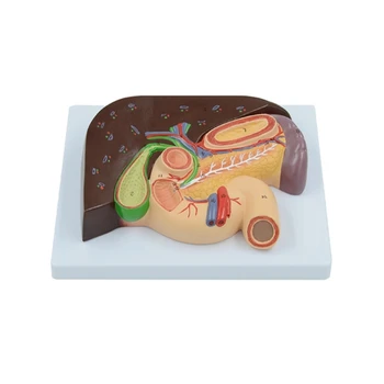 Анатомическая модель печени, желчного пузыря и поджелудочной железы для медицинского отчета об исследовании заболеваний. 0