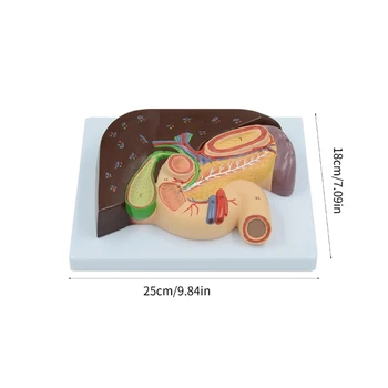 Анатомическая модель печени, желчного пузыря и поджелудочной железы для медицинского отчета об исследовании заболеваний. 5